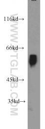 10175-2-AP - BCS1L / BCS1