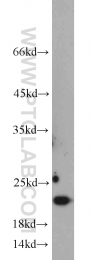 10988-1-AP - BID