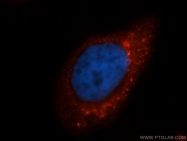 14941-1-AP - Bleomycin hydrolase