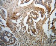 14941-1-AP - Bleomycin hydrolase
