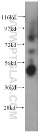 14941-1-AP - Bleomycin hydrolase