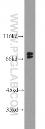 10855-1-AP - B-cell linker protein / BLNK