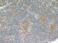 10775-1-AP - Biliverdin reductase A