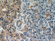 10775-1-AP - Biliverdin reductase A