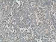 10775-1-AP - Biliverdin reductase A