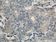 10775-1-AP - Biliverdin reductase A