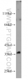 10775-1-AP - Biliverdin reductase A
