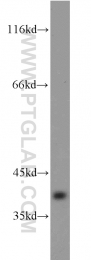 10775-1-AP - Biliverdin reductase A