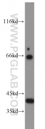 10775-1-AP - Biliverdin reductase A