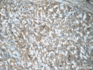 18982-1-AP - BMP15 / GDF9B