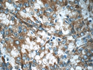 18982-1-AP - BMP15 / GDF9B