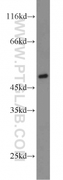 18982-1-AP - BMP15 / GDF9B