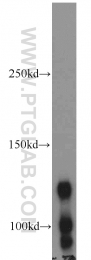 14376-1-AP - BMPR2