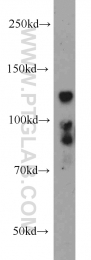 14376-1-AP - BMPR2