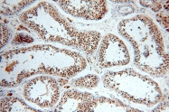20649-1-AP - BRCA1 / RNF53