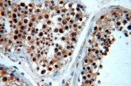 20649-1-AP - BRCA1 / RNF53