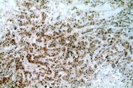 20649-1-AP - BRCA1 / RNF53