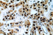 20649-1-AP - BRCA1 / RNF53