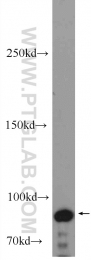 20649-1-AP - BRCA1 / RNF53