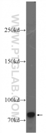 20649-1-AP - BRCA1 / RNF53