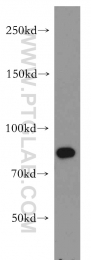 20649-1-AP - BRCA1 / RNF53