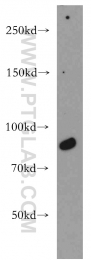 20649-1-AP - BRCA1 / RNF53