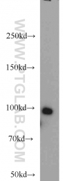 20649-1-AP - BRCA1 / RNF53