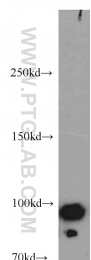 20649-1-AP - BRCA1 / RNF53