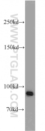 20649-1-AP - BRCA1 / RNF53