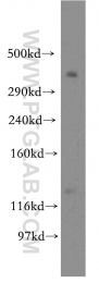 19791-1-AP - BRCA2 / FANCD1