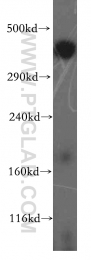 19791-1-AP - BRCA2 / FANCD1