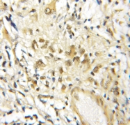 11859-1-AP - BRD3