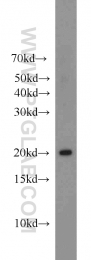 20049-1-AP - BRP44