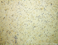 13557-1-AP - BRUNOL5 / CELF5