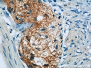 10870-1-AP - Betacellulin