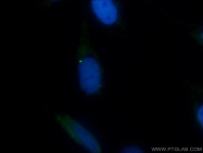 13330-1-AP - BUB1A