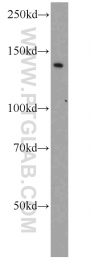 11504-2-AP - BUB1B