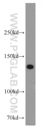 11504-2-AP - BUB1B