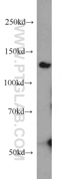 11504-2-AP - BUB1B