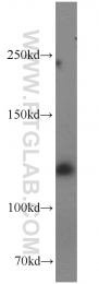 11504-2-AP - BUB1B