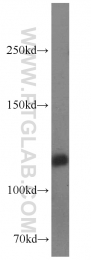 11504-2-AP - BUB1B