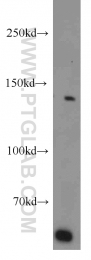 11504-2-AP - BUB1B
