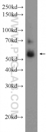 13104-1-AP - CBLC / RNF57