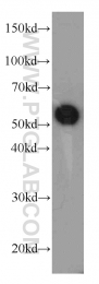13104-1-AP - CBLC / RNF57