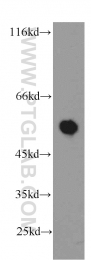 13104-1-AP - CBLC / RNF57