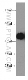 13104-1-AP - CBLC / RNF57