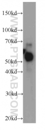 13104-1-AP - CBLC / RNF57