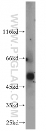 13104-1-AP - CBLC / RNF57