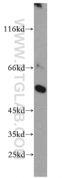 13104-1-AP - CBLC / RNF57