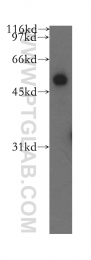 13104-1-AP - CBLC / RNF57